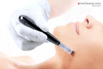 MedBeauty_Needling_Pen_Anwendung_Partner